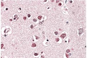 P32034PU-N Endophilin-A1 Antibody staining of paraffin embedded Human Cerebral Cortex. (SH3G2 antibody  (Internal Region))