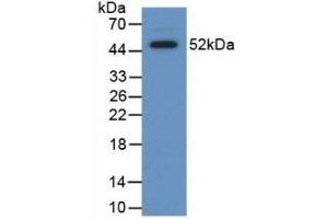 Detection of Recombinant SAP, Human using Polyclonal Antibody to Serum Amyloid P Component (SAP) (APCS antibody  (AA 23-223))