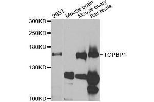 Western blot analysis of extracts of various cell lines, using TOPBP1 antibody. (TOPBP1 antibody)
