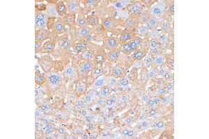 Immunohistochemistry (IHC) image for anti-Amyloid P Component, Serum (APCS) (AA 1-223) antibody (ABIN3022714)