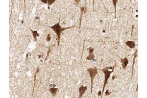 ABIN6266924 at 1/100 staining human brain tissue sections by IHC-P. (NRF2 antibody  (N-Term))