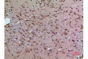 Immunohistochemistry (IHC) analysis of paraffin-embedded Rat Brain, antibody was diluted at 1:100. (Arginine antibody  (Internal Region))