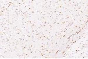 Immunohistochemistry analysis of paraffin-embedded mouse striatum using,CYPIVF11 (ABIN7073679) at dilution of 1: 12000