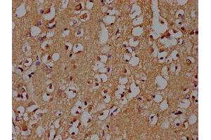 IHC image of ABIN7139719 diluted at 1:100 and staining in paraffin-embedded human brain tissue performed on a Leica BondTM system. (SNCA antibody  (AA 119-136))