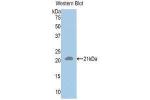 Western Blotting (WB) image for anti-RAD50 Homolog (S. Cerevisiae) (RAD50) (AA 631-793) antibody (ABIN1860394) (RAD50 antibody  (AA 631-793))