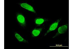 Immunofluorescence of monoclonal antibody to RUNDC2A on HeLa cell. (SNX29 antibody  (AA 1-249))