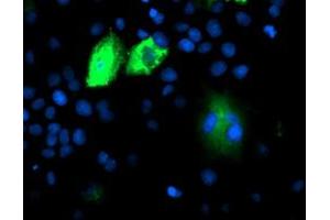 Anti-DPP9 mouse monoclonal antibody (ABIN2455302) immunofluorescent staining of COS7 cells transiently transfected by pCMV6-ENTRY DPP9 (RC224465). (DPP9 antibody)