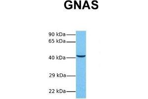 Host:  Rabbit  Target Name:  GNAS  Sample Tissue:  Human MCF7  Antibody Dilution:  1.