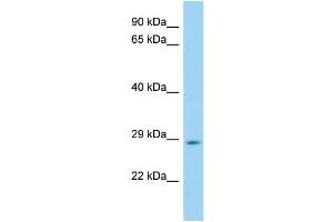 WB Suggested Anti-Hes6 Antibody Titration: 1. (HES6 antibody  (Middle Region))