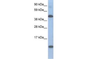 Western Blotting (WB) image for anti-Ligand Dependent Nuclear Receptor Corepressor (Lcor) antibody (ABIN2461545) (Lcor antibody)
