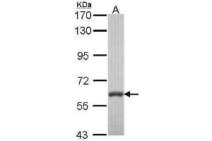 Western Blotting (WB) image for anti-Membrane Protein, Palmitoylated 6 (MAGUK P55 Subfamily Member 6) (MPP6) (N-Term) antibody (ABIN2856554)
