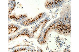 Immunohistochemistry (IHC) image for anti-Transient Receptor Potential Cation Channel, Subfamily C, Member 6 (TRPC6) antibody (ABIN2426989)