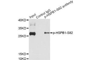 Immunoprecipitation analysis of 200 μg extracts of HeLa cells treated by EGF using 2. (HSP27 antibody  (pSer82))
