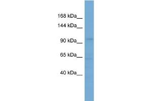 WB Suggested Anti-SLCO5A1 Antibody Titration: 0. (SLCO5A1 antibody  (Middle Region))