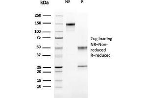 SDS-PAGE Analysis Purified Cathepsin K Mouse Monoclonal Antibody (CTSK/2791). (Cathepsin K antibody  (AA 163-274))