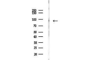 anti-Collagen, Type IX, alpha 1 (COL9A1) (Internal Region) antibody