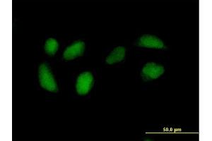 Immunofluorescence of purified MaxPab antibody to RPE on HeLa cell. (RPE antibody  (AA 1-228))