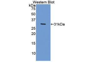 Western blot analysis of the recombinant protein. (Versican antibody  (AA 2958-3209))