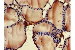 Immunohistochemistry of paraffin-embedded human thyroid tissue using ABIN7153070 at dilution of 1:100 (FOXN1 antibody  (AA 1-160))