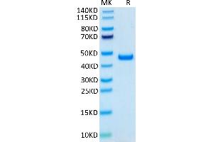 Human SLPI on Tris-Bis PAGE under reduced condition. (SLPI Protein (AA 26-132) (Fc Tag))