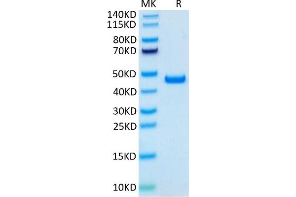 SLPI Protein (AA 26-132) (Fc Tag)