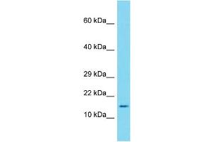 Host:  Rabbit  Target Name:  Saa1  Sample Type:  Mouse Thymus lysates  Antibody Dilution:  2. (SAA1 antibody  (Middle Region))