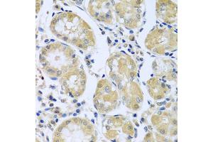 Immunohistochemistry of paraffin-embedded human stomach using FBXL5 antibody. (FBXL5 antibody)