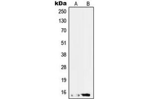 Western blot analysis of SAP14 expression in HepG2 (A), RT4 (B) whole cell lysates. (Pre-mRNA Branch Site Protein p14 (SF3B14) (C-Term) antibody)