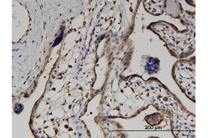 Immunoperoxidase of monoclonal antibody to UPB1 on formalin-fixed paraffin-embedded human placenta.