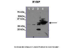 Lanes:   1. (RYBP antibody  (C-Term))