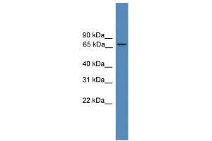 WB Suggested Anti-ZNF304 Antibody Titration: 0.