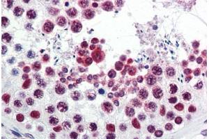 Human Testis (formalin-fixed, paraffin-embedded) stained with ATF6 antibody ABIN351434 at 5 ug/ml followed by biotinylated goat anti-rabbit IgG secondary antibody ABIN481713, alkaline phosphatase-streptavidin and chromogen. (ATF6 antibody  (C-Term))