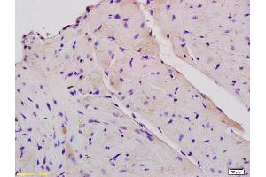 Formalin-fixed and paraffin embedded mouse heart tissue labeled with Anti-CPT1B Polyclonal Antibody, Unconjugated (ABIN708851) at 1:200, followed by conjugation to the secondary antibody and DAB staining (CPT1B antibody  (AA 501-600))