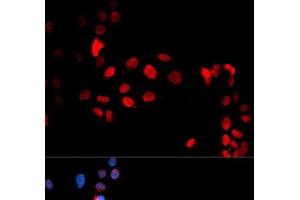 Immunofluorescence analysis of U2OS cells using Phospho-MAX(S11) Polyclonal Antibody (MAX antibody  (pSer11))