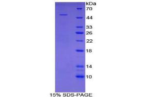 SDS-PAGE (SDS) image for Angiopoietin 4 (ANGPT4) (AA 305-503) protein (His tag,GST tag) (ABIN2122399) (Angiopoietin 4 Protein (ANGPT4) (AA 305-503) (His tag,GST tag))