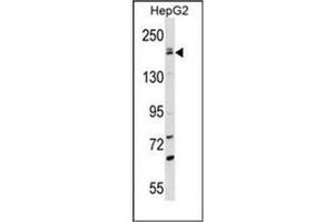 Western blot analysis of NTE Antibody (C-term) in HepG2 cell line lysates (35ug/lane). (PNPLA6 antibody  (C-Term))