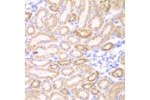 Immunohistochemistry of paraffin-embedded rat kidney using GOT1 antibody at dilution of 1:200 (400x lens). (GOT1 antibody)