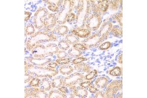 Immunohistochemistry of paraffin-embedded rat kidney using GOT1 antibody at dilution of 1:200 (400x lens).