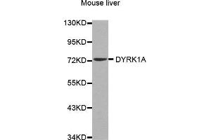 Western Blotting (WB) image for anti-Dual-Specificity tyrosine-(Y)-phosphorylation Regulated Kinase 1A (DYRK1A) (AA 624-763) antibody (ABIN6213900) (DYRK1A antibody  (AA 624-763))