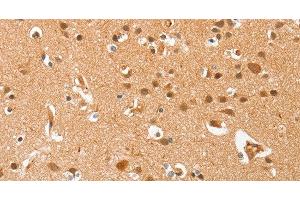Immunohistochemistry of paraffin-embedded Human brain using AHSG Polyclonal Antibody at dilution of 1:60 (Fetuin A antibody)