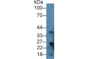 Western blot analysis of Rat Liver lysate, using Rat RGN Antibody (1 µg/ml) and HRP-conjugated Goat Anti-Rabbit antibody ( (Regucalcin antibody  (AA 1-299))