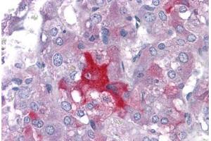 Human Adrena: Formalin-Fixed, Paraffin-Embedded (FFPE) (LMTK2 antibody  (AA 1181-1280))