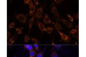 Immunofluorescence analysis of NIH-3T3 cells using VPS25 Polyclonal Antibody at dilution of 1:100 (40x lens). (VPS25 antibody)