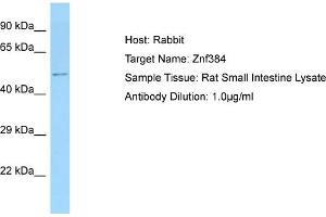Host: Rabbit Target Name: ZNF384 Sample Tissue: Rat Small Intestine Antibody Dilution: 1ug/ml (ZNF384 antibody  (N-Term))