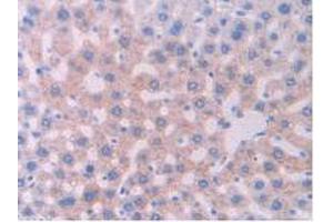 IHC-P analysis of Rat Liver Tissue, with DAB staining. (CYP1A1 antibody  (AA 251-521))