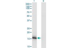 Western Blot analysis of AGR2 expression in transfected 293T cell line by AGR2 monoclonal antibody (M07), clone 7E8. (AGR2 antibody  (AA 1-175))