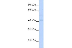 WB Suggested Anti-GSDML Antibody Titration:  0. (Gasdermin B antibody  (N-Term))
