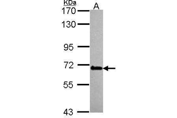DDX56 antibody  (Center)