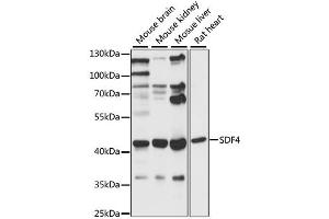 Western blot analysis of extracts of various cell lines, using SDF4 antibody (ABIN6290972) at 1:1000 dilution.