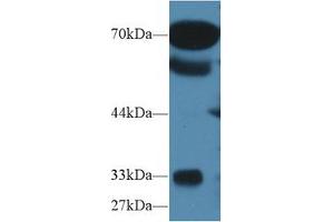Western blot analysis of Human Serum, using Human OS9 Antibody (1 µg/ml) and HRP-conjugated Goat Anti-Rabbit antibody (
